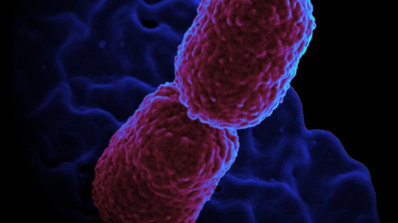 Colorized scanning electron micrograph showing carbapenem-resistant Klebsiella pneumoniae. Image Wikimedia Commons