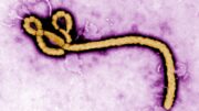 There are currently no licenced treatments for non-Zaire strains, and no vaccines. Image from CDC Global, CC BY 2.0 , via Wikimedia Commons
