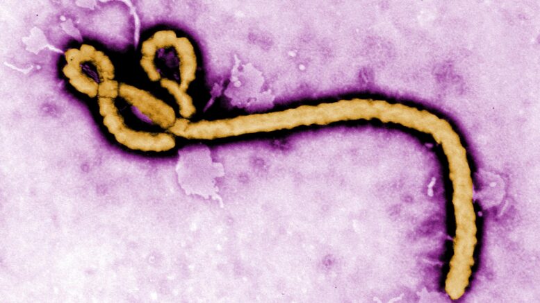 There are currently no licenced treatments for non-Zaire strains, and no vaccines. Image from CDC Global, CC BY 2.0 , via Wikimedia Commons